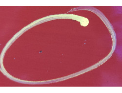 c574862ab47790ebcc6af568f8b8fc6c